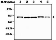 MAB0834 - RPS6KA2 / RSK3