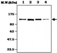 MAB0839 - FAK1 / PTK2