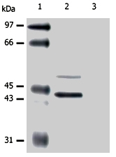 MAB0853 - Cytokeratin 5