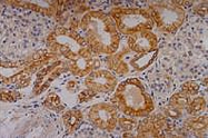 MAB0857 - Cytokeratin 18
