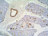 MAB0859 - Cytokeratin 7