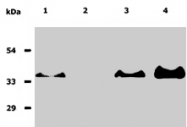 MAB0881 - CD20