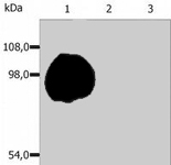 MAB0884 - CD43 / Leukosialin
