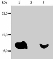 MAB0899 - Beta-2-microglobulin