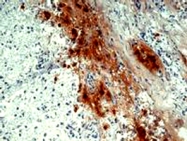 MAB0905 - POMC