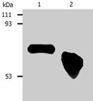 MAB0906 - Alpha-fetoprotein / AFP