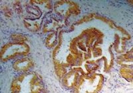 MAB0915 - Kallikrein-3 / PSA / KLK3