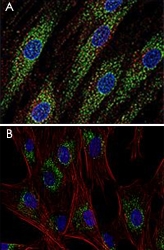 MAB0931 - CD63
