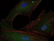 MAB0947 - FYN