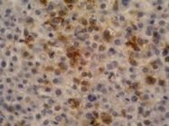 MAB0954 - Alpha-fetoprotein / AFP