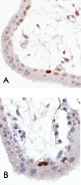MAB0977 - TP53 / p53