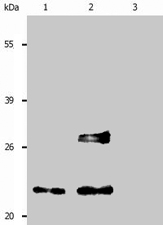 MAB0985 - CD9
