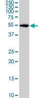 MAB0989 - GSK3 alpha