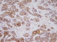 MAB1051 - Tumor protein D53 (TPD52L1)