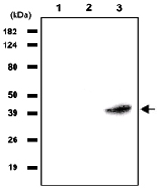 MAB1056 - RASSF1