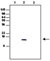MAB1057 - CD336
