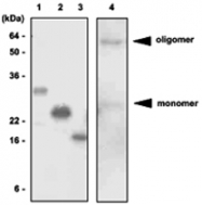 MAB1063 - Adiponectin