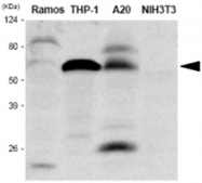 MAB1068 - IRF5