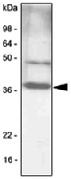 MAB1069 - CEBPB