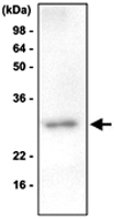 MAB1074 - VHL