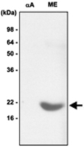 MAB1075 - Alpha-crystallin B chain / CRYA2