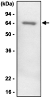 MAB1077 - SERPINF1 / PEDF