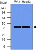 MAB1082 - Nucleophosmin