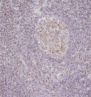 MAB1082 - Nucleophosmin