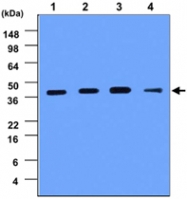MAB1083 - Cathepsin D