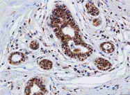 MAB1083 - Cathepsin D