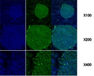 MAB1085 - Endoplasmin / HSP90B1 / TRA1