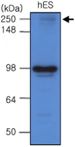 MAB1085 - Endoplasmin / HSP90B1 / TRA1
