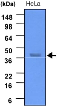 MAB1086 - Casein kinase II subunit alpha