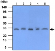 MAB1089 - C-reactive protein (CRP)