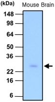 MAB1093 - Phosphoserine phosphatase