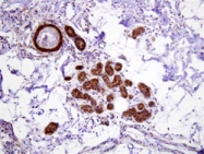 MAB1094 - Heat shock protein 70 / HSP70