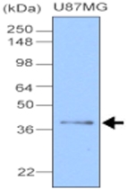 MAB1098 - Apolipoprotein J / Apo J