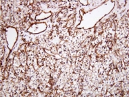 MAB1098 - Apolipoprotein J / Apo J