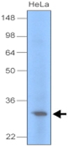 MAB1099 - Uracil-DNA glycosylase (UNG)