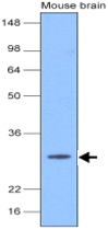 MAB1100 - UCHL1 / PGP9.5