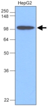 MAB1101 - Hexokinase-1