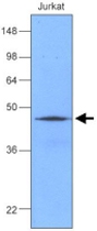 MAB1102 - DNAJA1 / HDJ2