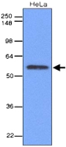 MAB1103 - IRF3
