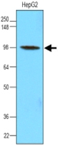 MAB1104 - Hexokinase-3