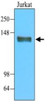 MAB1108 - CD45 / LCA