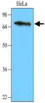 MAB1110 - WHSC1L1 / NSD3