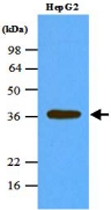 MAB1112 - PPP1CA