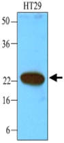 MAB1113 - CIB1