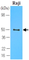 MAB1116 - CD196 / CCR6