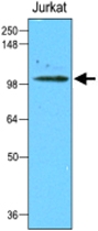 MAB1118 - Hexokinase-2